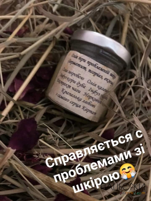 композиція при псоріазі,дерматитах,екземі